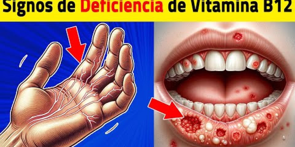 Propiedades del romero, beneficios saludables y precauciones de uso